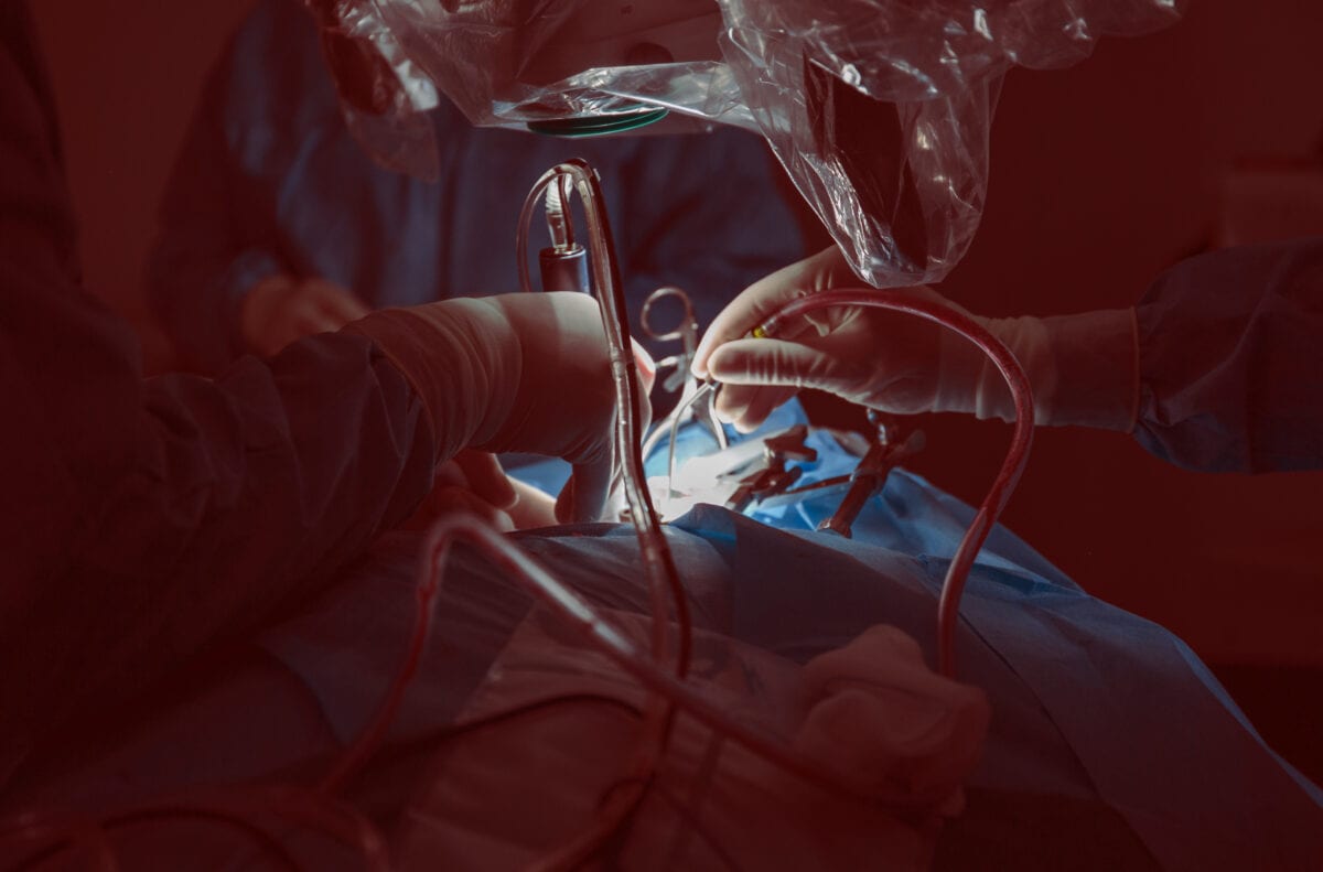 Αρτηριοφλεβώδεις δυσπλασίες