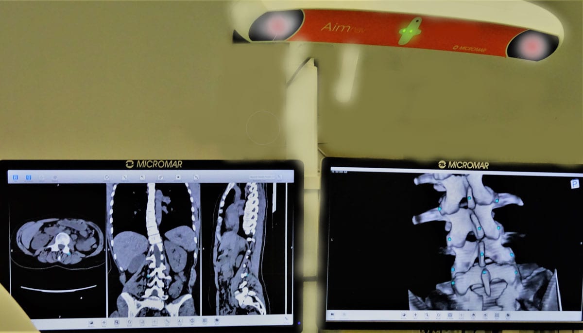 Χειρουργική θωρακικής μοίρας πλευρεγκαρσιεκτομή